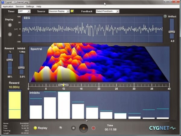 Sierra EEG | Weight Maps